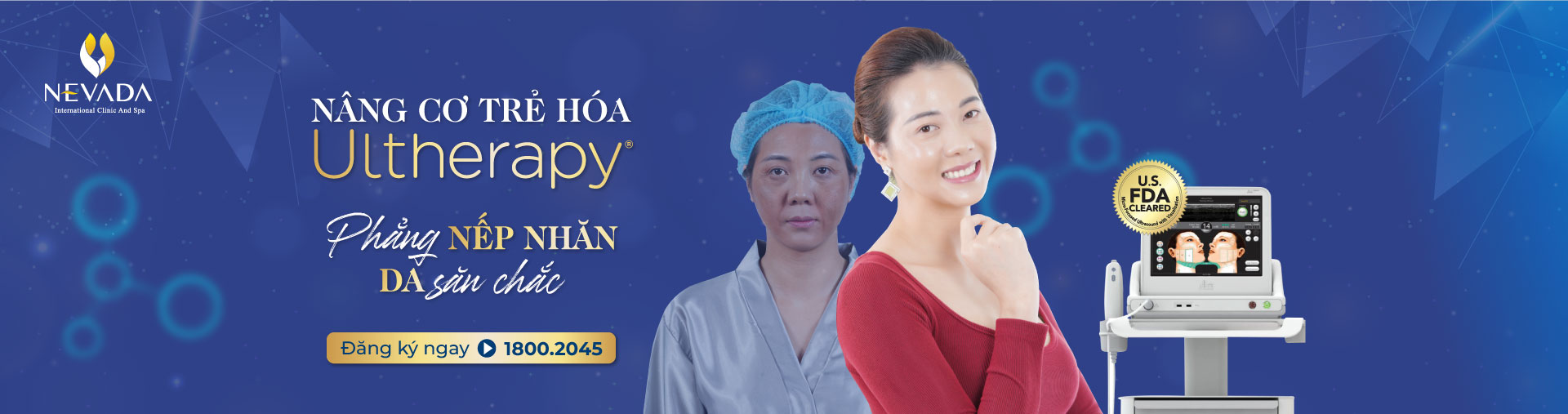 Banner Ultherapy PC